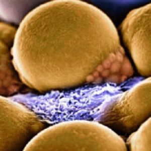 grasso massa-muscolare-e-grasso-300x184