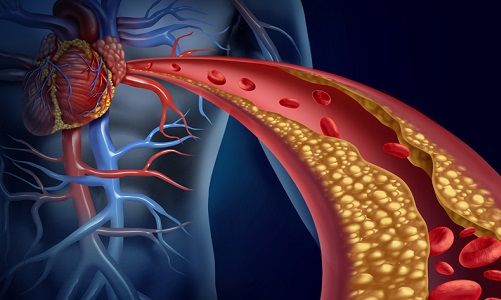 colesterolo sangue corsa e colesterolo nel sangue